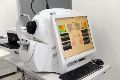 光学相干断层扫描血管成像系统（OCT－A）